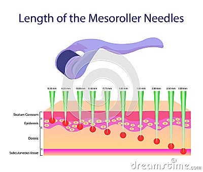 Length of the mesoroller needles, Vector illustration Vector Illustration
