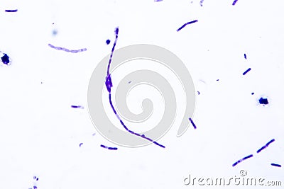 Light micrograph of bacteria Bacillus anthracis Stock Photo