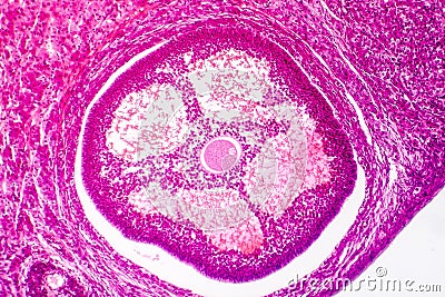 Light micrograph of human ovary Stock Photo