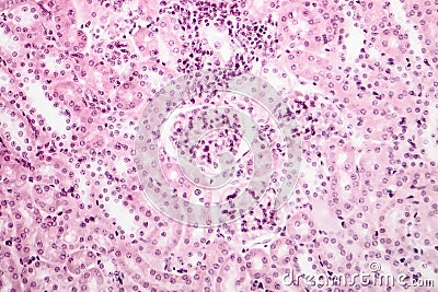 Light micrograph of a kidney Stock Photo