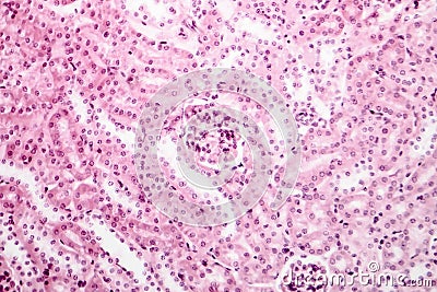 Light micrograph of a kidney Stock Photo