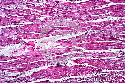 Light microscope Cardiac callosity pathplogy Stock Photo