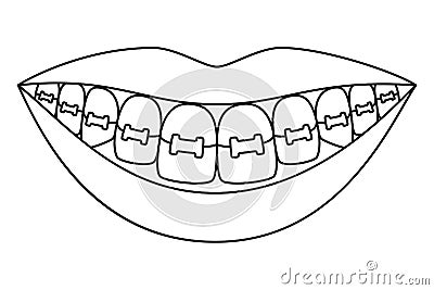 Line art black and white healthy smile in braces Vector Illustration