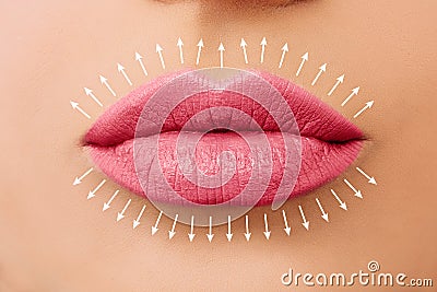 Lip augmentation. Fillers. Beautiful perfect pink lips Stock Photo