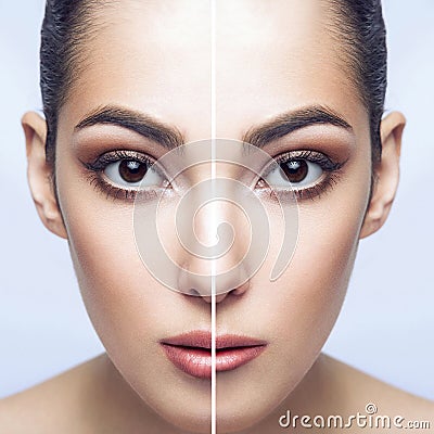 Before and after lip filler injections. Lip augmentation perfect lips. Closeup half portrait of beautiful brunette woman lips Stock Photo