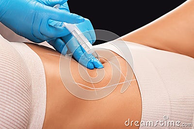 Lipolytic injections for burning fat on the abdomen, legs and thighs of a woman. Women's aesthetic cosmetology Stock Photo