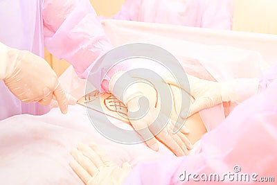Liposuction operation. Doctor hands near belly Stock Photo