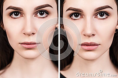 Lips of young woman before and after augmentation Stock Photo