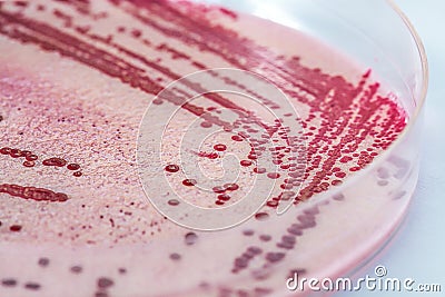 Listeria Stock Photo