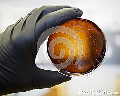 Listeria monocytogenes on agar Stock Photo