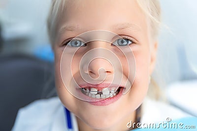 Little blond happy kid girl at dentist office smiling showing diastema overbite teeth missing gap. Child during Stock Photo