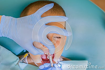 A little boy at a dentist's reception in a dental clinic. Children's dentistry, Pediatric Dentistry. A female stomatologist is Stock Photo