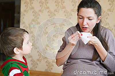 The little boy looks at a sick pregnant mother. Pregnant young woman with nosebleed. Severe pregnancy concept Stock Photo