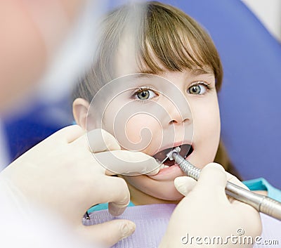 Little girl with open mouth during drilling treatm Stock Photo