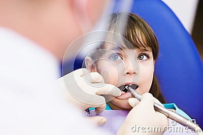 Little girl with open mouth during drilling treatm Stock Photo