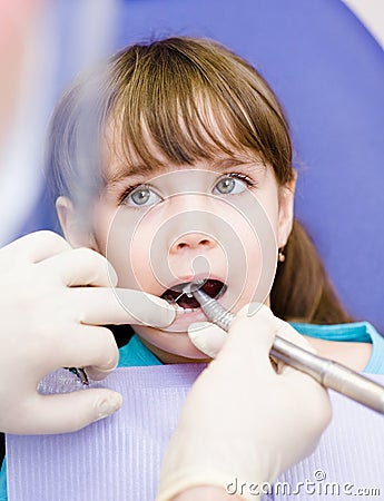 Little girl with open mouth during drilling treatm Stock Photo