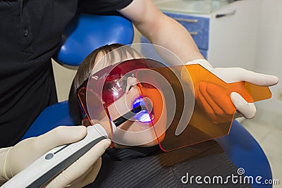 The little girl is receiving medical treatment of the stomatologist, doing procedure with dental curing UV light in clinic Stock Photo