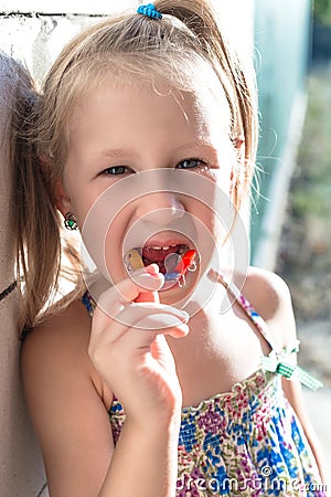 Little girl shows his orthodontic appliance Stock Photo