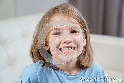Little girl shows a reeling tooth. changing milk teeth to indigenous teeth. Stock Photo