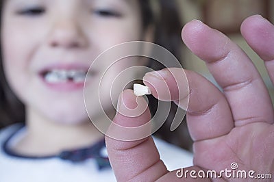 Little 5 years old girl showing her first baby tooth fallen out Stock Photo