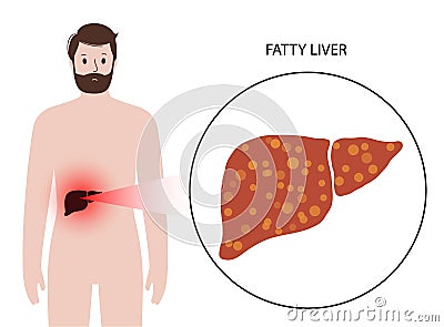 Liver disease concept Vector Illustration