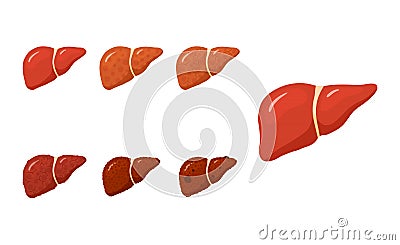 Liver diseases concept in flat style, vector Vector Illustration
