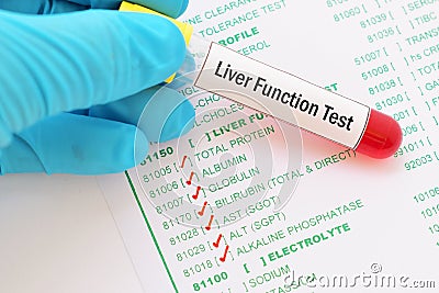 Liver function test Stock Photo