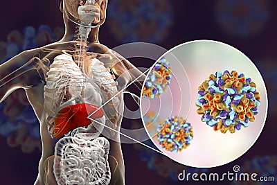 Liver with Hepatitis B infection and close-up view of Hepatitis B Viruses Cartoon Illustration