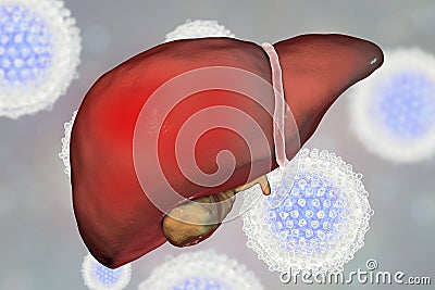 Liver with Hepatitis C infection and close-up view of Hepatitis C Virus Cartoon Illustration