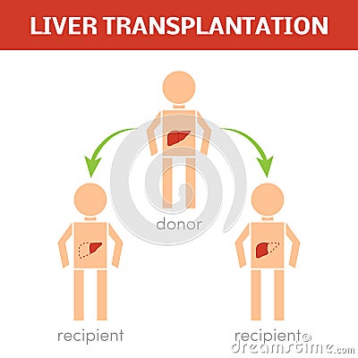 Liver transplantation concept Stock Photo