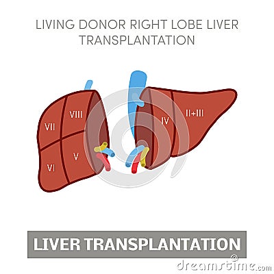 Liver transplantation concept Stock Photo