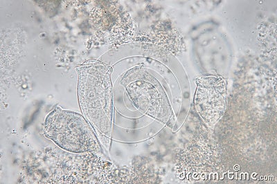 Living Vorticella is a genus of protozoan Stock Photo