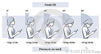 Load pressure neck head tilt angle vector illustration Vector Illustration