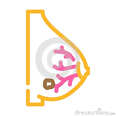 lobular breast cancer color icon vector illustration Cartoon Illustration