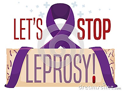 Purple Ribbon Protecting a Sign and Promoting to Stop Leprosy, Vector Illustration Vector Illustration