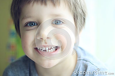 Lost tooth Stock Photo