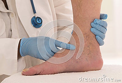 Lower limb vascular examination by phlebologist Stock Photo