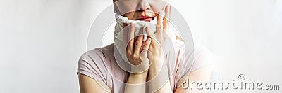 Lower part part of woman face with Red bubbles of virus herpes on her lips she tries to hide it under white knitted neckwarmer, Stock Photo