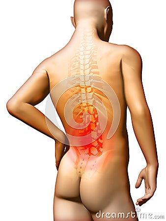 Lumbar pain Cartoon Illustration