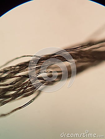 Lump of threads observed under a laboratory microscope. Stock Photo