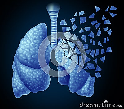 Lung Illness Stock Photo