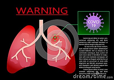 Lung Infection by Covid-19 virus, vector Vector Illustration
