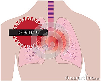 Lungs affected with coronavirus infection COVID19 Vector Illustration