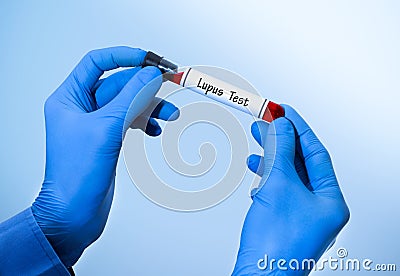 Lupus test Stock Photo