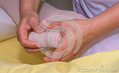 Lymphedema management: Wrapping leg using multilayer bandages to control Lymphedema. Part of complete decongestive therapy cdt a Stock Photo