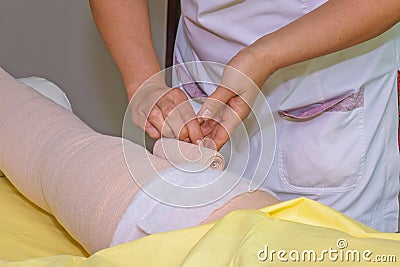 Lymphedema management: Wrapping leg using multilayer bandages to control Lymphedema. Part of complete decongestive therapy cdt a Stock Photo