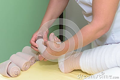 Lymphedema management: Wrapping leg using multilayer bandages to control Lymphedema. Part of complete decongestive therapy cdt a Stock Photo