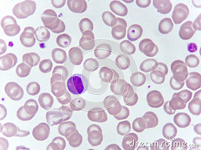 Lymphocyte cell in blood smear Stock Photo