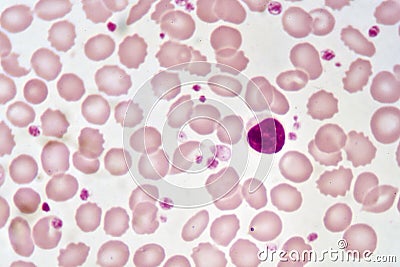 Lymphocyte cell Stock Photo