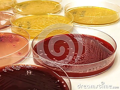 Mac Conkey agar in Petri dish, Selective isolation of Enterobacteriaceae and Escherichia coli. Culture medium for bacteria. Stock Photo